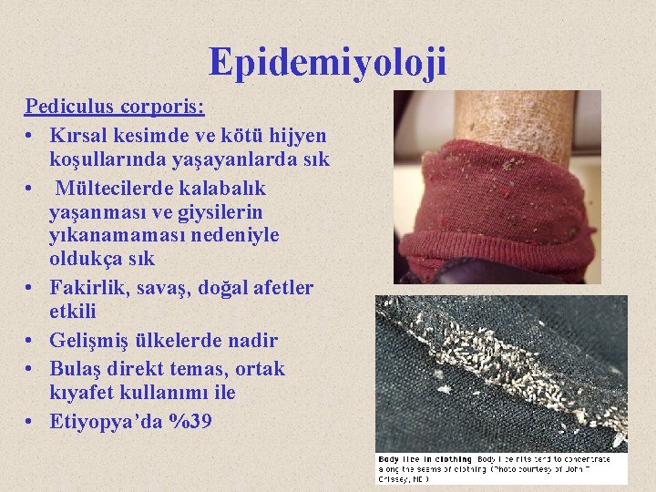 Epidemiyoloji Pediculus corporis: • Kırsal kesimde ve kötü hijyen koşullarında yaşayanlarda sık • Mültecilerde
