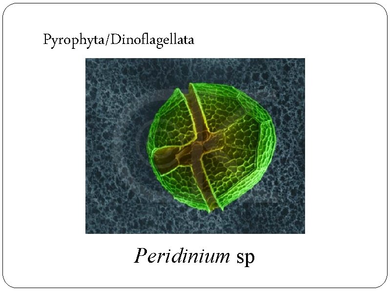 Pyrophyta/Dinoflagellata Peridinium sp 