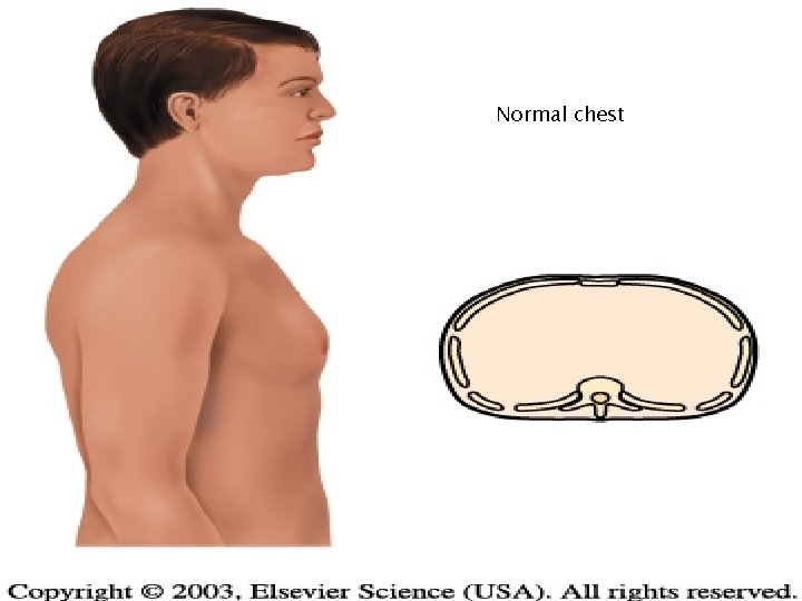 Normal chest 