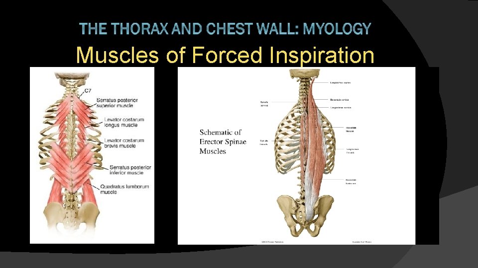 Muscles of Forced Inspiration 