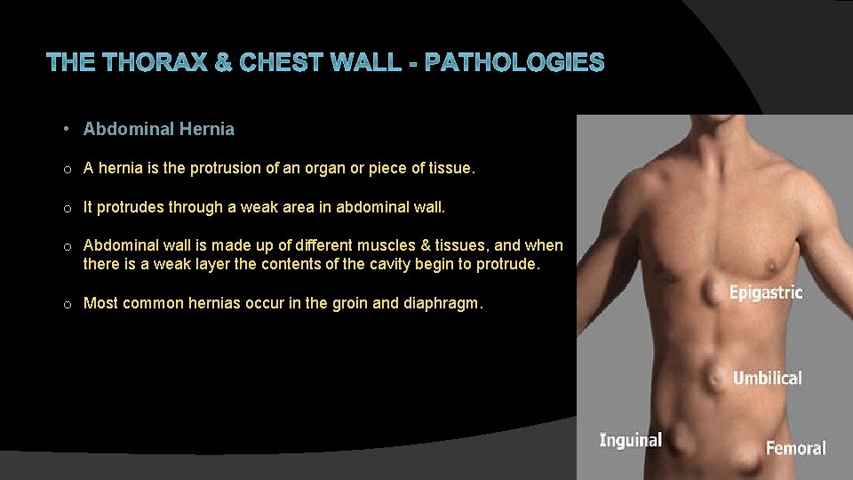 THE THORAX & CHEST WALL - PATHOLOGIES • Abdominal Hernia o A hernia is