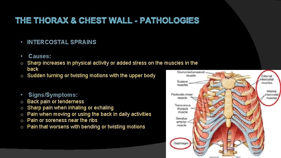 THE THORAX & CHEST WALL - PATHOLOGIES • INTERCOSTAL SPRAINS • Causes: o Sharp