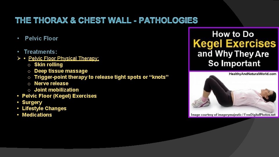THE THORAX & CHEST WALL - PATHOLOGIES • Pelvic Floor • Treatments: Ø •