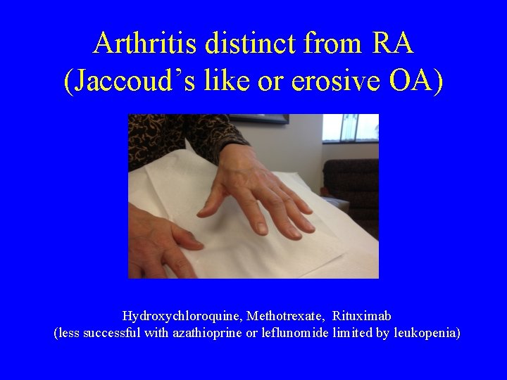 Arthritis distinct from RA (Jaccoud’s like or erosive OA) Hydroxychloroquine, Methotrexate, Rituximab (less successful