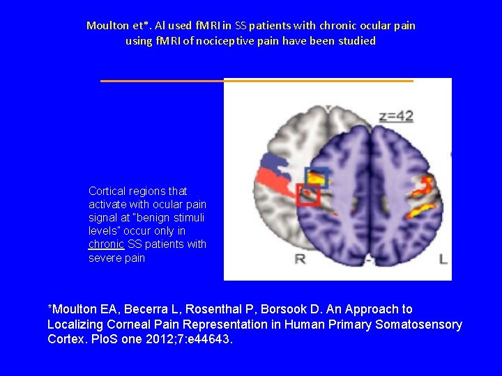 Moulton et*. Al used f. MRI in SS patients with chronic ocular pain using