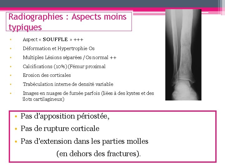 Radiographies : Aspects moins typiques • Aspect « SOUFFLE » +++ • Déformation et