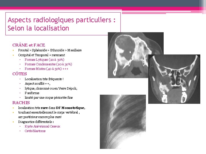 Aspects radiologiques particuliers : Selon la localisation CR NE et FACE • • Frontal