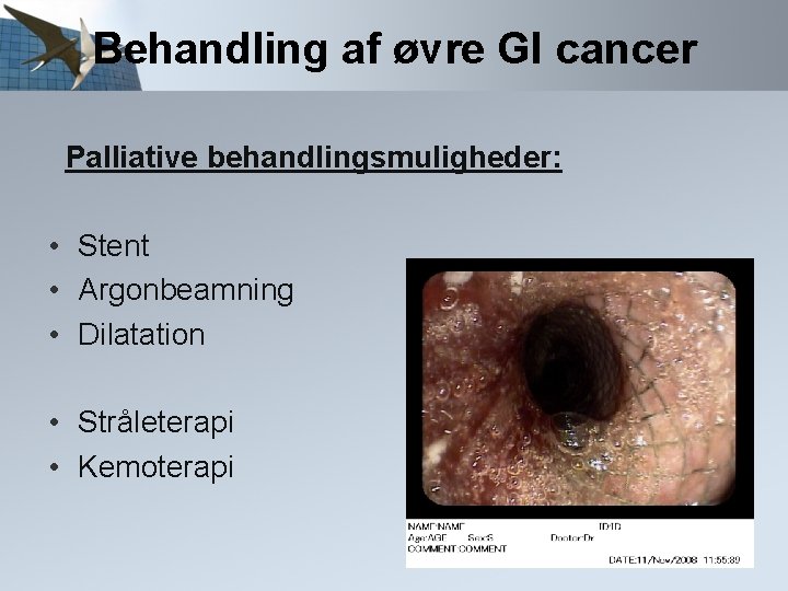 Behandling af øvre GI cancer Palliative behandlingsmuligheder: • Stent • Argonbeamning • Dilatation •