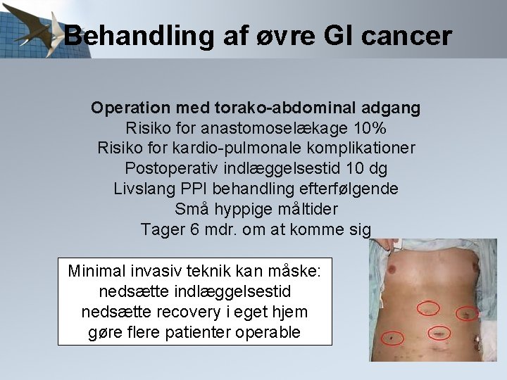 Behandling af øvre GI cancer Operation med torako-abdominal adgang Risiko for anastomoselækage 10% Risiko