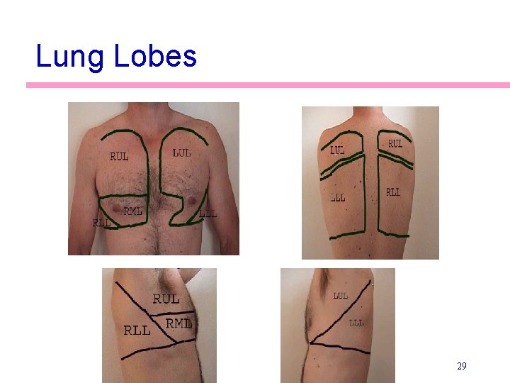 Lung Lobes 29 