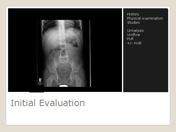 History Physical examination Studies Urinalysis Uroflow PVR +/- KUB Initial Evaluation 