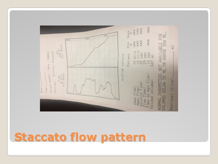 Staccato flow pattern 