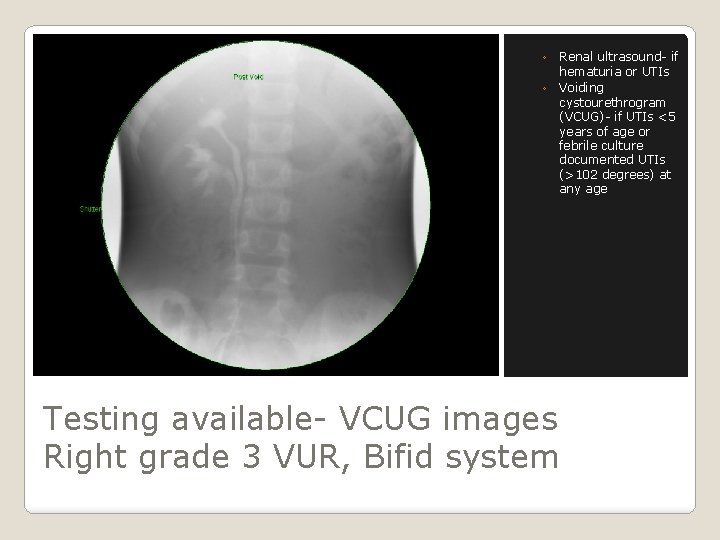 ◦ Renal ultrasound- if hematuria or UTIs ◦ Voiding cystourethrogram (VCUG)- if UTIs <5