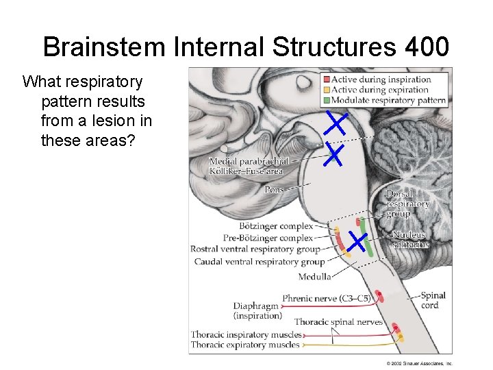 Brainstem Internal Structures 400 What respiratory pattern results from a lesion in these areas? Brainstem Internal Structures 400 What respiratory pattern results from a lesion in these areas?