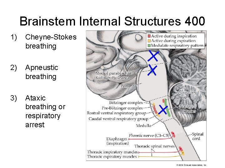 Brainstem Internal Structures 400 1) Cheyne-Stokes breathing 2) Apneustic breathing 3) Ataxic breathing or Brainstem Internal Structures 400 1) Cheyne-Stokes breathing 2) Apneustic breathing 3) Ataxic breathing or