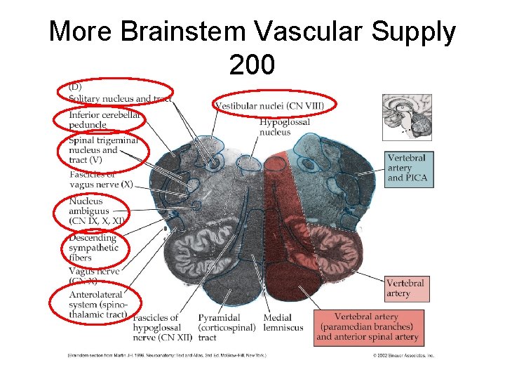 More Brainstem Vascular Supply 200 More Brainstem Vascular Supply 200