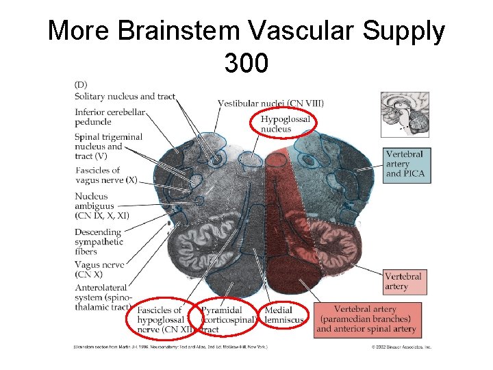More Brainstem Vascular Supply 300 More Brainstem Vascular Supply 300