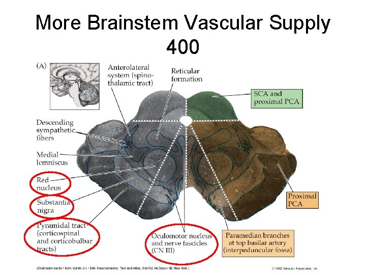 More Brainstem Vascular Supply 400 More Brainstem Vascular Supply 400
