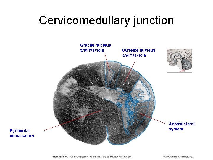 Cervicomedullary junction Gracile nucleus and fascicle Pyramidal decussation Cuneate nucleus and fascicle Anterolateral system Cervicomedullary junction Gracile nucleus and fascicle Pyramidal decussation Cuneate nucleus and fascicle Anterolateral system