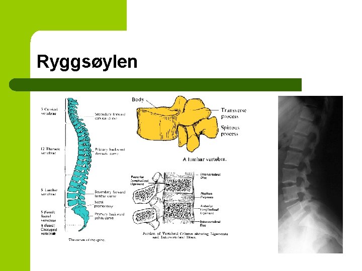 Ryggsøylen 