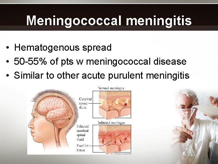 Meningococcal meningitis • Hematogenous spread • 50 -55% of pts w meningococcal disease •