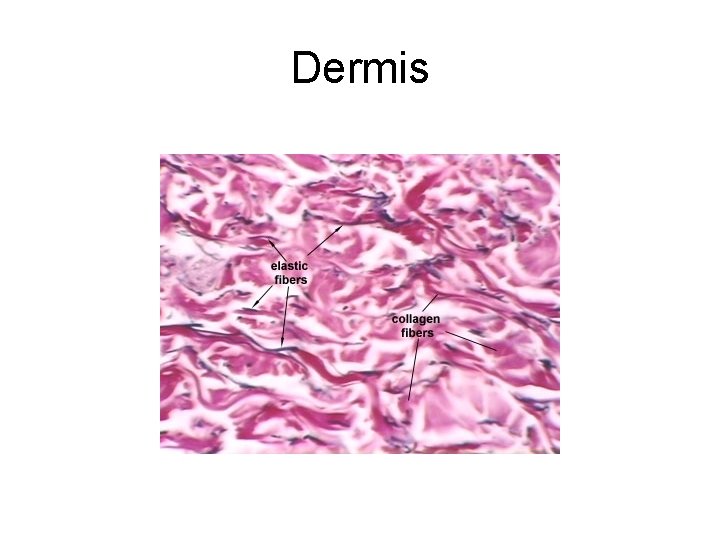 Dermis 