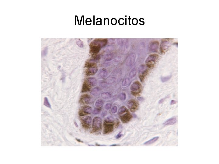 Melanocitos 