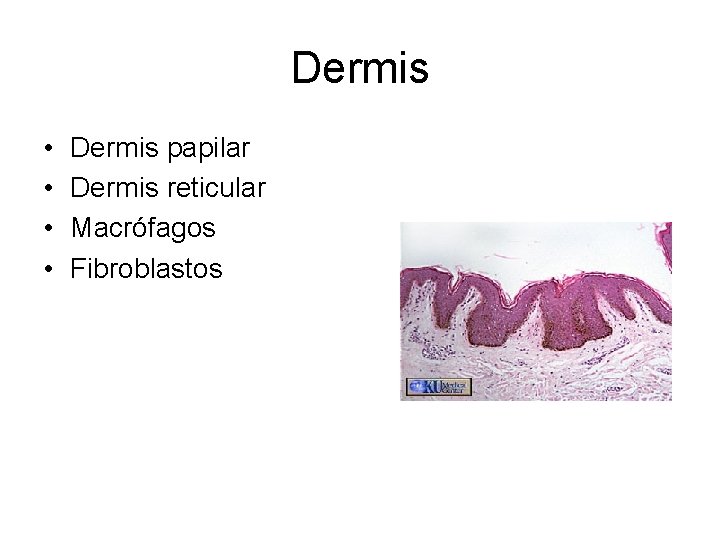 Dermis • • Dermis papilar Dermis reticular Macrófagos Fibroblastos 