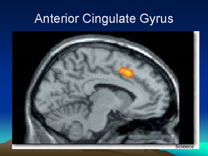 Anterior Cingulate Gyrus 