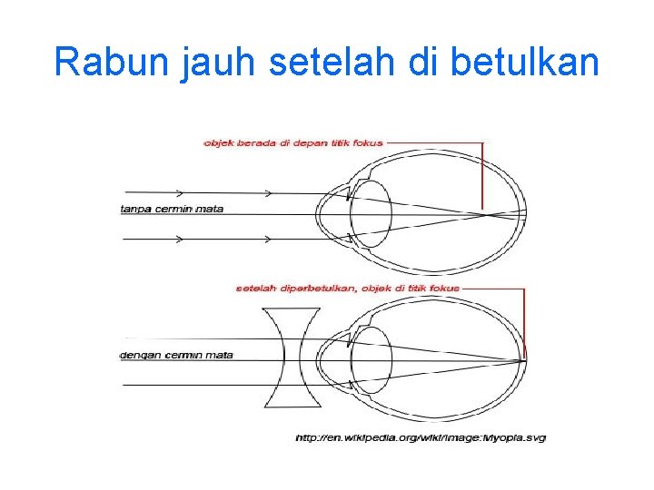 Rabun jauh setelah di betulkan 