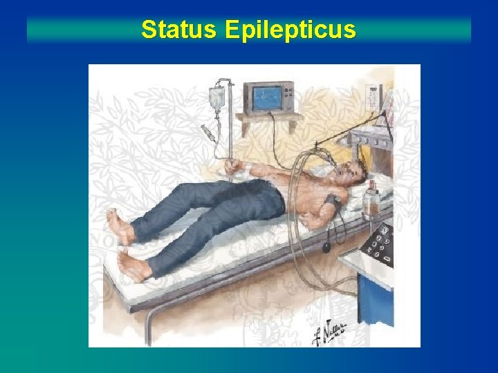 Status Epilepticus 