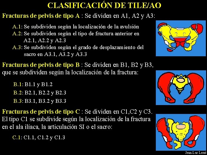 CLASIFICACIÓN DE TILE/AO Fracturas de pelvis de tipo A : Se dividen en A