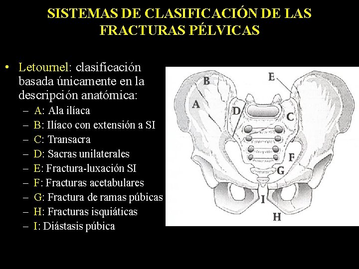 SISTEMAS DE CLASIFICACIÓN DE LAS FRACTURAS PÉLVICAS • Letournel: clasificación basada únicamente en la