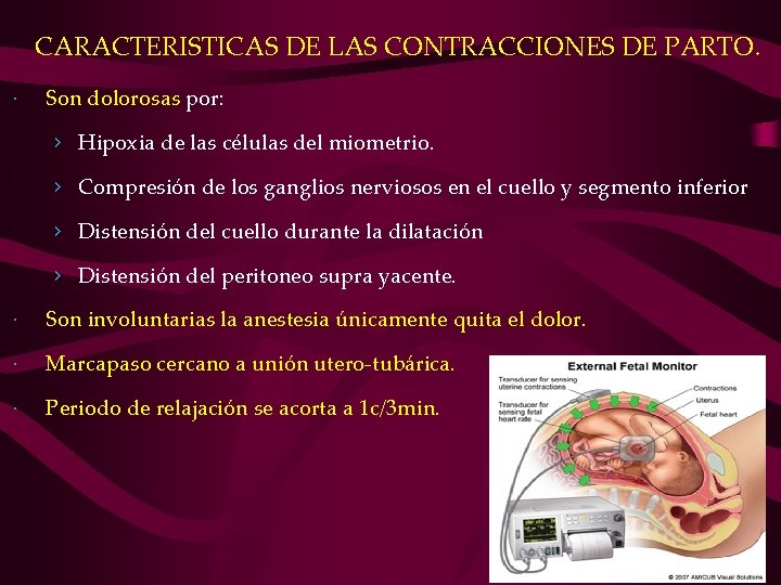 CARACTERISTICAS DE LAS CONTRACCIONES DE PARTO. Son dolorosas por: › Hipoxia de las células