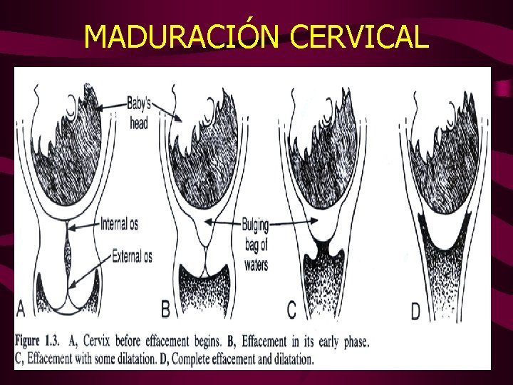 MADURACIÓN CERVICAL 