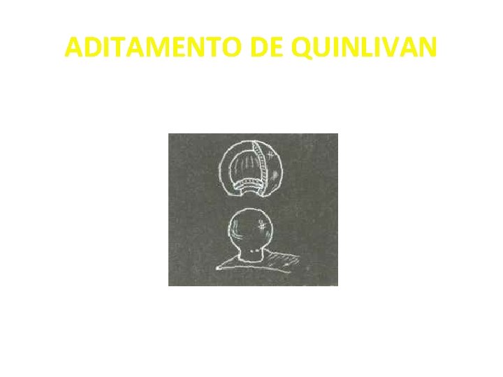 ADITAMENTO DE QUINLIVAN 