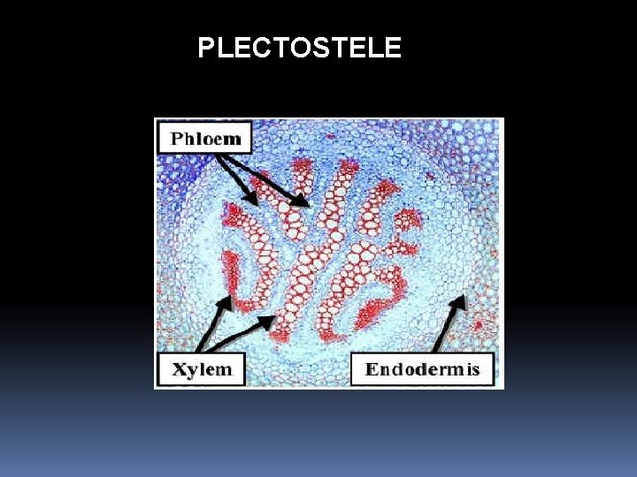 PLECTOSTELE 