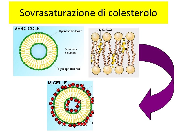 Sovrasaturazione di colesterolo VESCICOLE MICELLE 