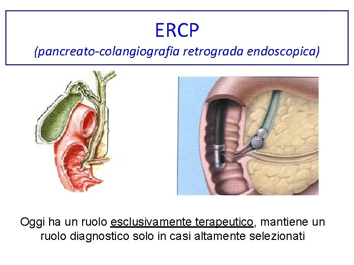 ERCP (pancreato-colangiografia retrograda endoscopica) Oggi ha un ruolo esclusivamente terapeutico, mantiene un ruolo diagnostico