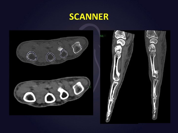 SCANNER 