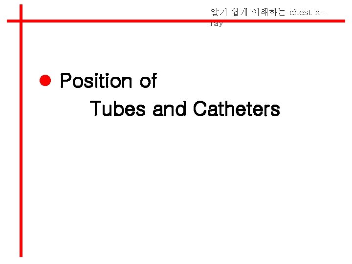 알기 쉽게 이해하는 chest xray l Position of Tubes and Catheters 