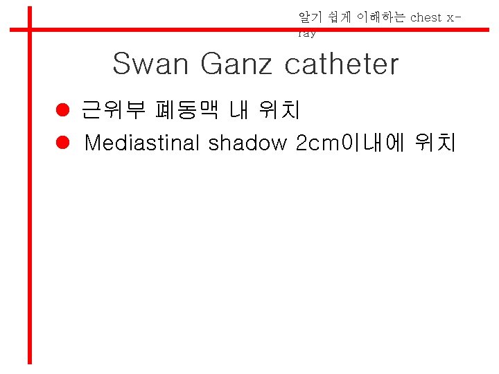 알기 쉽게 이해하는 chest xray Swan Ganz catheter l 근위부 폐동맥 내 위치 l