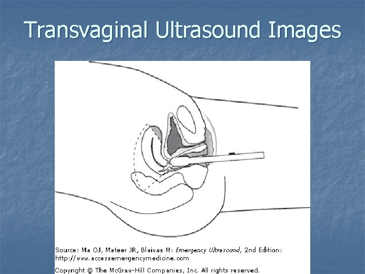 Transvaginal Ultrasound Images 