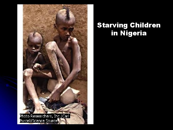 Starving Children in Nigeria 