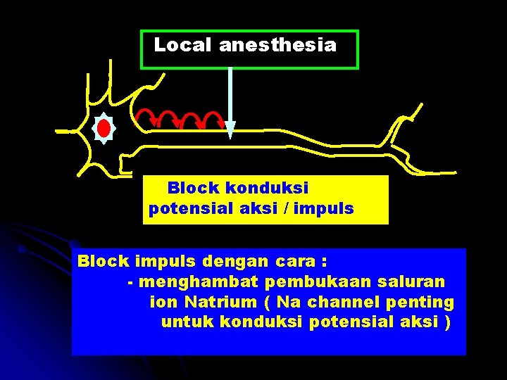 Local anesthesia Block konduksi potensial aksi / impuls Block impuls dengan cara : -