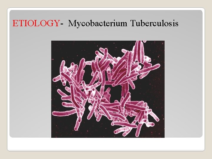 ETIOLOGY- Mycobacterium Tuberculosis 