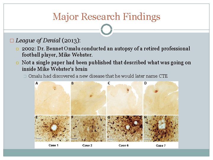 Major Research Findings � League of Denial (2013): 2002: Dr. Bennet Omalu conducted an