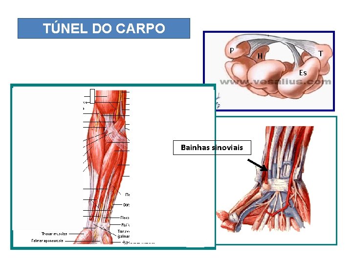 TÚNEL DO CARPO Túnel do carpo P T H Es Bainhas sinoviais 