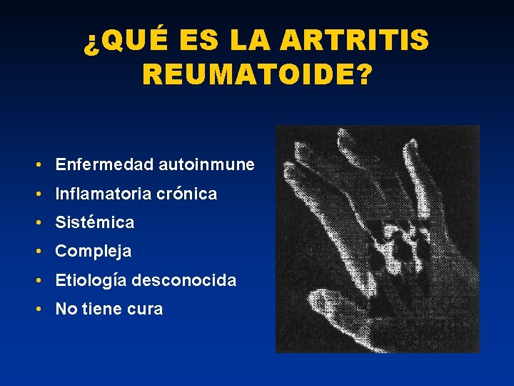 ¿QUÉ ES LA ARTRITIS REUMATOIDE? • Enfermedad autoinmune • Inflamatoria crónica • Sistémica •