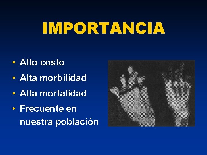 IMPORTANCIA • Alto costo • Alta morbilidad • Alta mortalidad • Frecuente en nuestra